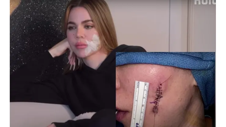 La estrella de Internet reveló cómo lucía su rostro tras la eliminación de un melanoma
