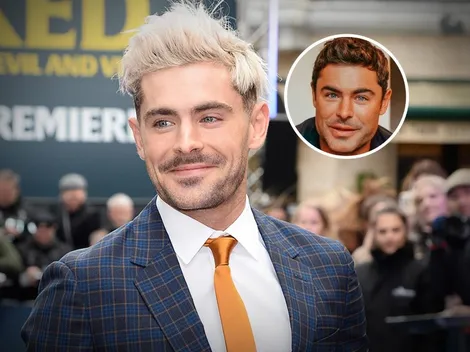 Confirman si Zac Efron se hizo una cirugía en el rostro
