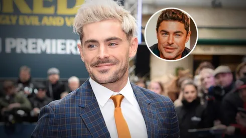 Confirman si Zac Efron se hizo una cirugía en la cara.