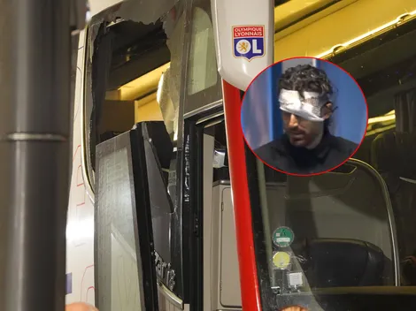Escándalo en Francia: apedrearon el micro de Lyon y Fabio Grosso fue herido