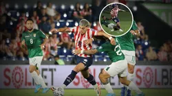 Impactante lesión del jugador paraguayo de Talleres.