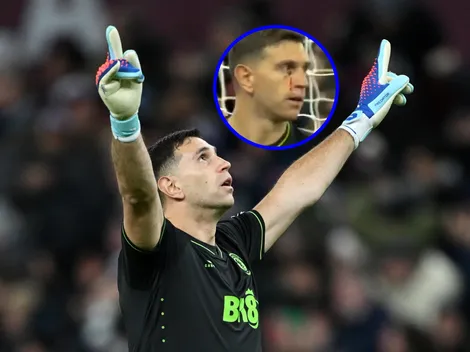 Terminó hasta con un corte en el pómulo: sobrio partido de Dibu Martínez ante Arsenal