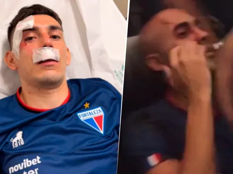 Bombardearon el micro de Fortaleza en Brasil: hay 2 argentinos heridos