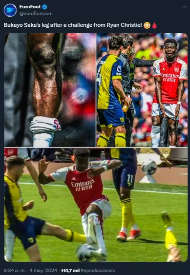 Patada de Ryan Christie y una brutal herida para Bukayo Saka (Twitter).