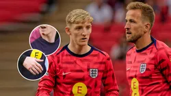 Un futbolista de Inglaterra apareció golpeado en el entrenamiento