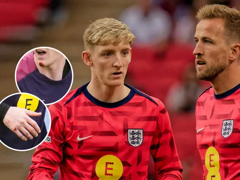 Un jugador de Inglaterra apareció golpeado en el entrenamiento y disparó los rumores en la Eurocopa 2024