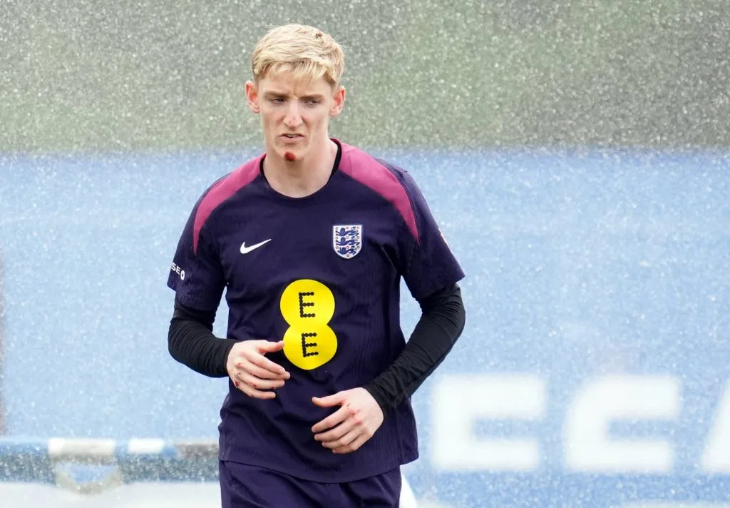 Anthony Gordon presentó marcas luego de golpearse con una mountain bike.