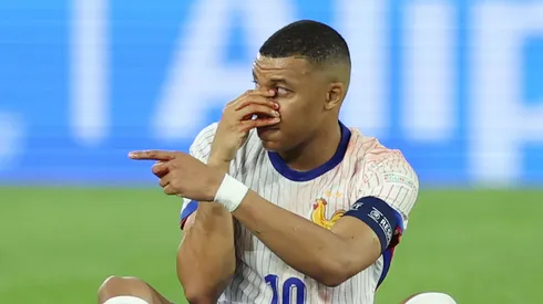Mbappé sufrió una fractura de nariz.