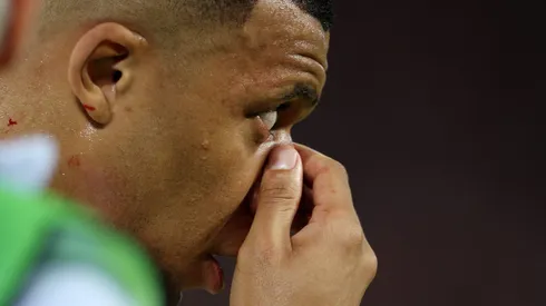 Mbappé no pudo terminar el partido ante Austria.