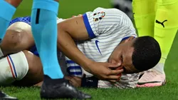 Así quedó Kylian Mbappé después del golpe.