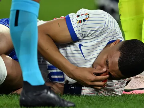 Mbappé no se operará tras la dura lesión en su nariz