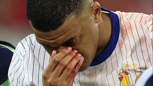 Durísimo golpe en la Eurocopa.