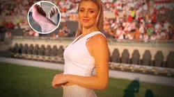 La historia de Morena Beltrán que asustó a todos en Instagram: "Es fractura"