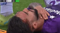 Así quedó Nicolás González.