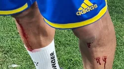 "Heridas de guerra": un jugador de Boca terminó ensangrentado por un motivo insólito