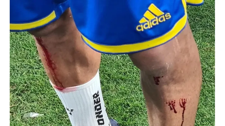 "Heridas de guerra": un jugador de Boca terminó ensangrentado por un motivo insólito