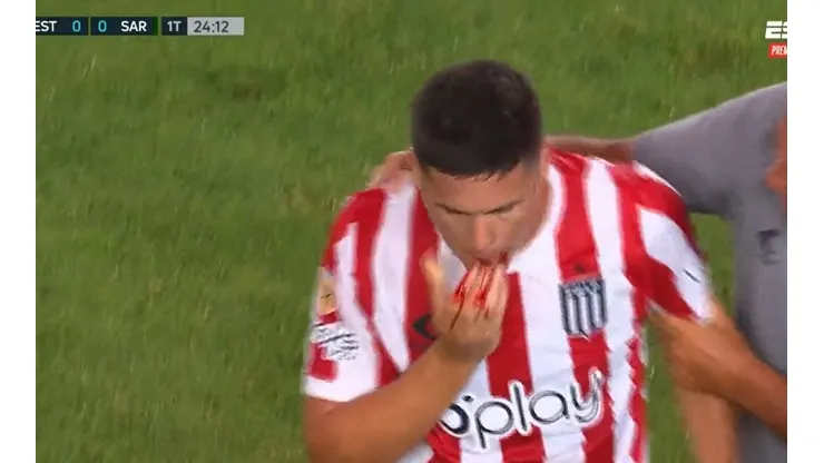 VIDEO | No apto para impresionables: Carrillo fue a cabecear y le volaron dos dientes