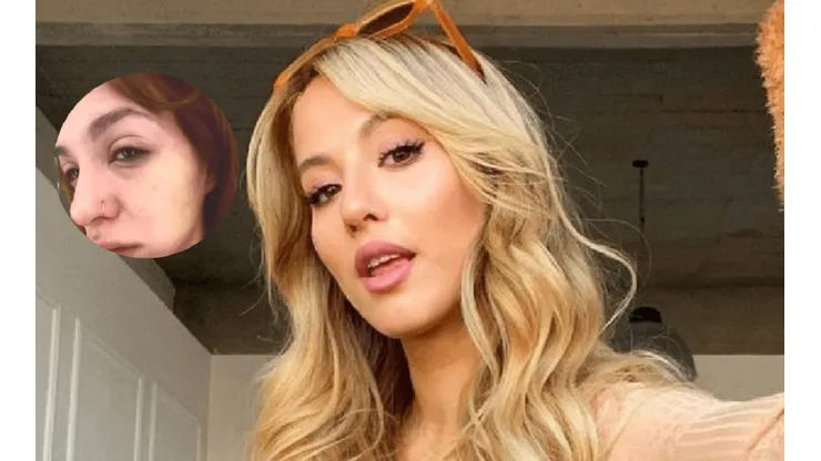 Se le hinchó el rostro a Flor Vigna.