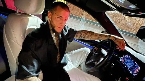 Alex Canigiga se operó la cara.