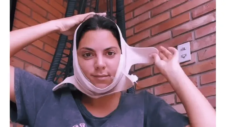 Belu Lucius se sometió a una retoque estético.