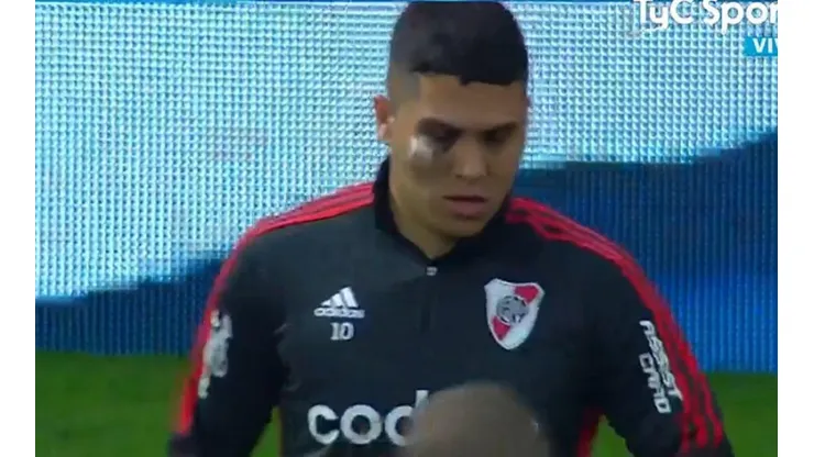¿Qué le pasó a Juanfer Quintero en el ojo?
