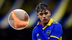 No apto para impresionables: el video del tobillo de Zeballos.