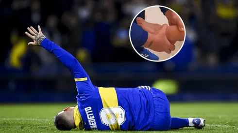 Benedetto mostró su tobillo.