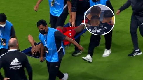 VIDEO | La escalofriante lesión de Robert Rojas y la reacción de todo River a ver su pierna