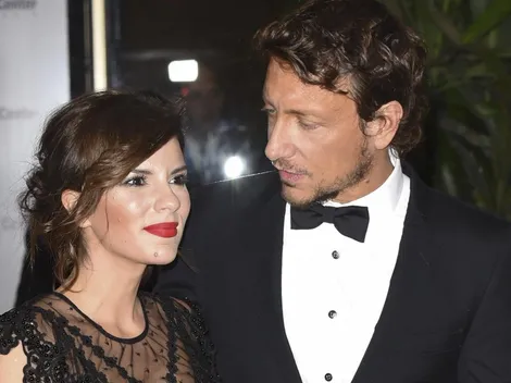 Gimena Accardi dio detalles de su operación en sus redes sociales luego de sufrir un accidente doméstico