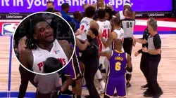 Escándalo en la NBA: insultos, sangre y corridas por un golpe de LeBron James a Isaiah Stewart