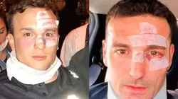 El disfraz de Halloween más insólito: se vistió de Scaloni tras su choque en bicicleta