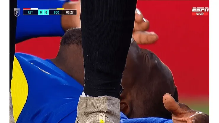 Así quedó Luis Advíncula.