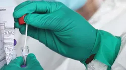 ¿Cuántos casos confirmados de COVID-19 hubo el 6 de julio en Argentina? (Foto: Getty).)