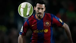 Gianluca Zambrotta sufre una extraña deformidad.