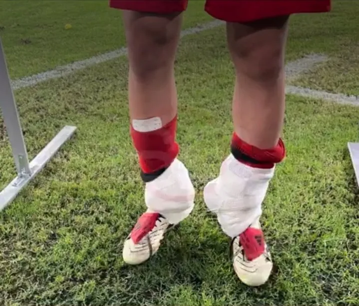 Así terminó Franco Mastantuono. (Foto: @SC_ESPN).