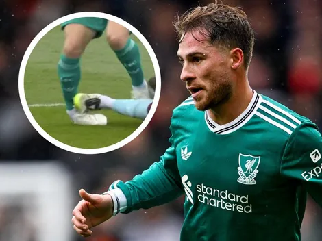 Mac Allister sorprende al Liverpool y reaparece tras la patada que recibió vs. Burnley