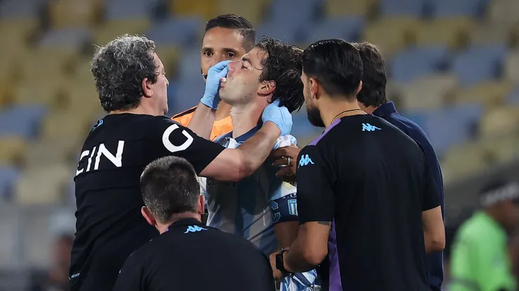 Santiago Sosa sufrió una fractura ante Flamengo.