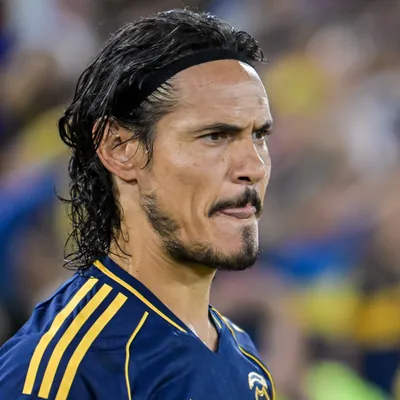 Boca hoy: Edinson Cavani quiere operarse, Carlos Palacios habló de su futuro y más