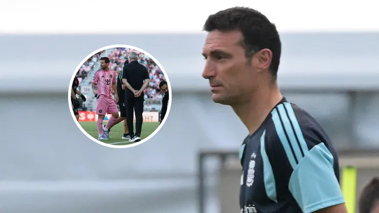 Lionel Scaloni dijo que las noticias sobre la lesión de Lionel Messi, en principio, no son tan malas.