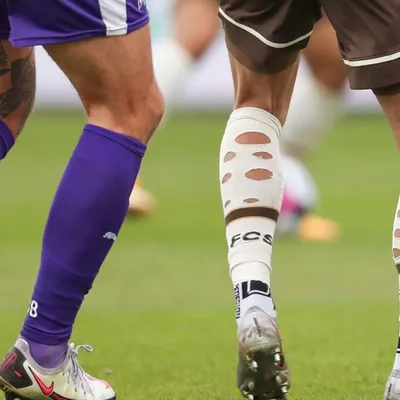 ¿Por qué muchos jugadores tienen las medias cortadas o rotas durante los partidos?