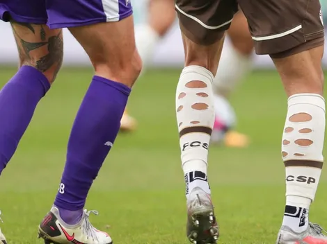 ¿Por qué muchos jugadores tienen las medias cortadas o rotas durante los partidos?