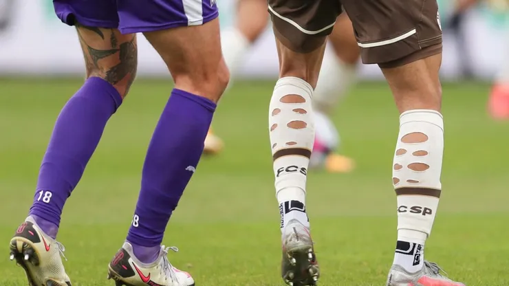 Muchos futbolistas utilizan las medias cortadas o rotas durante los partidos.