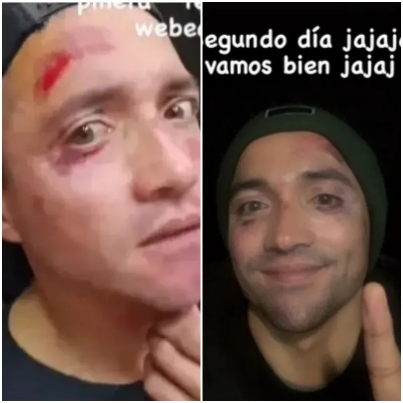 Así quedó el rostro del ex arquero de la U (Instagram)