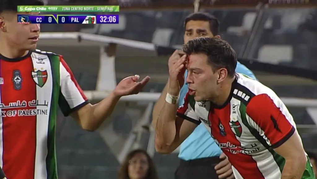 Fernando Meza quedó con un corte en su frente tras la patada de Jeyson Rojas (Captura TNT Sports)