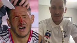 Ramiro González se refirió a la lesión que sufrió en el amistoso de Colo Colo vs Rosario Central. (Foto: Captura)