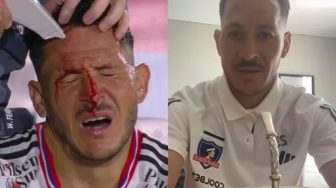 Ramiro González se refirió a la lesión que sufrió en el amistoso de Colo Colo vs Rosario Central. (Foto: Captura)
