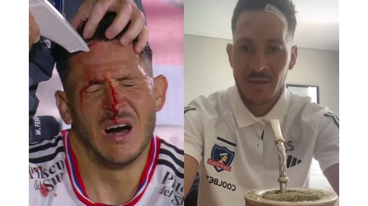 Ramiro González se refirió a la lesión que sufrió en el amistoso de Colo Colo vs Rosario Central. (Foto: Captura)
