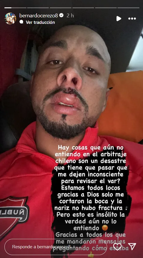 Bernardo Cerezo muestra su molestia contra el VAR.