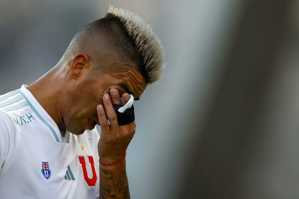 Leandro Fernández se mantendrá al margen por tres partidos en Universidad de Chile.