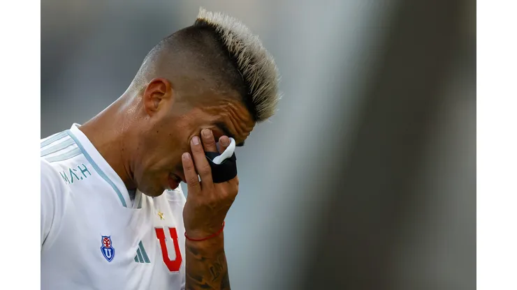 Leandro Fernández se mantendrá al margen por tres partidos en Universidad de Chile.